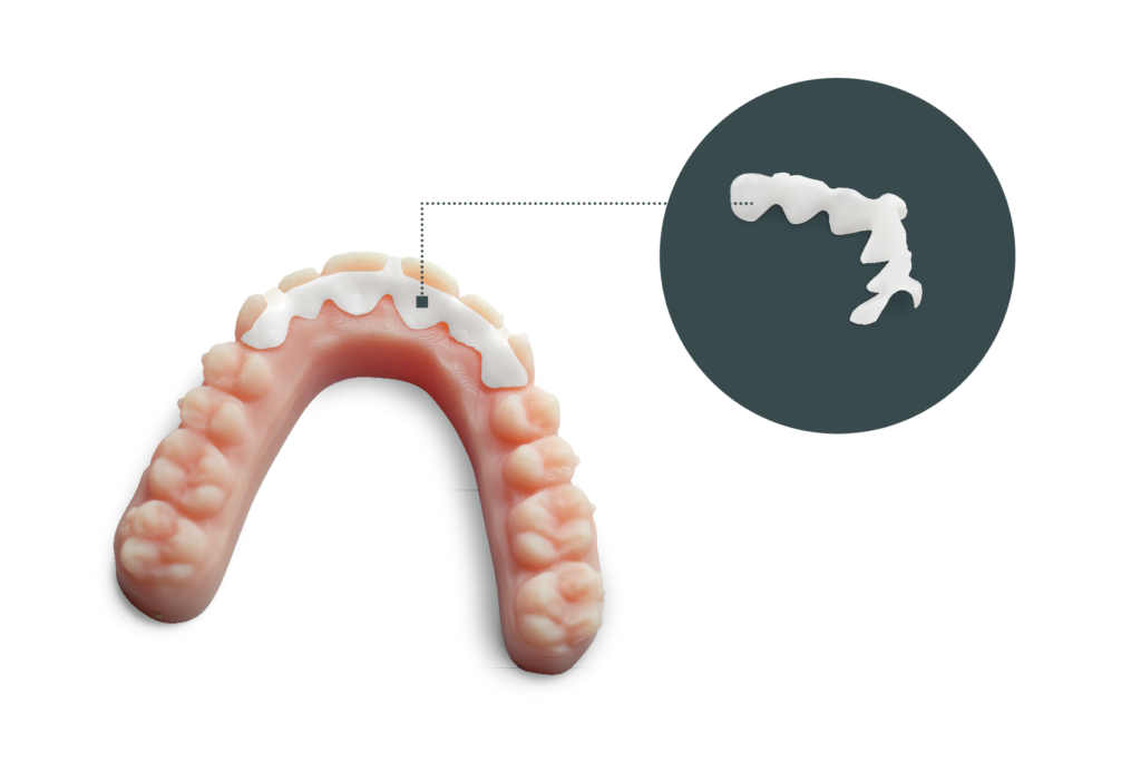 Retainers Biotech Dental